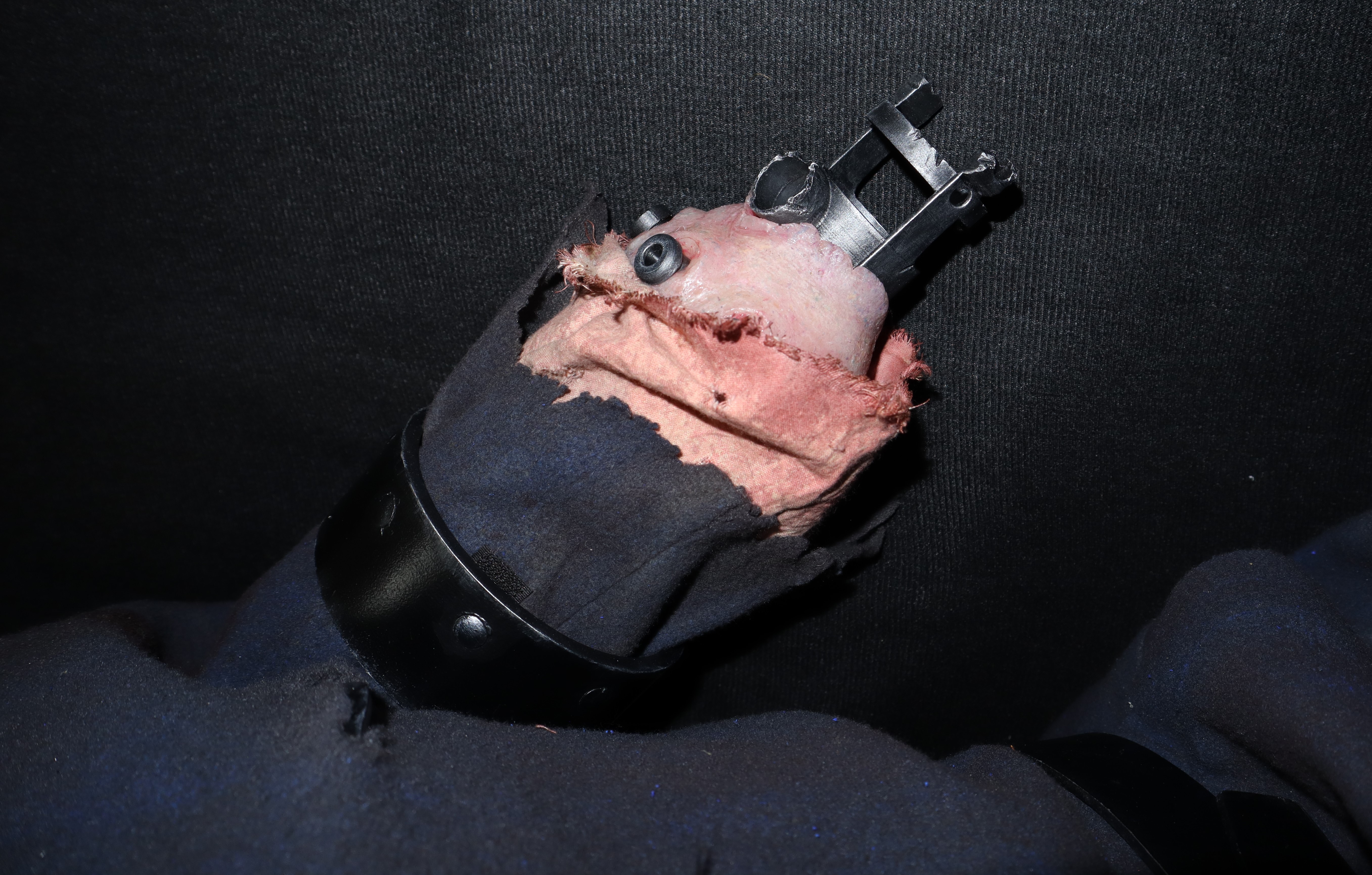 A view of the left arm, showing broken metal parts interfaced with the skin and dressed in bloody shirt fabric and a torn sleeve of the coat